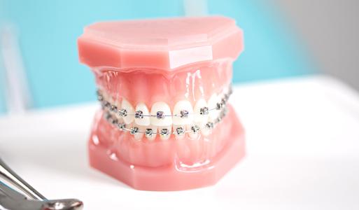 牙齿矫正期间怎样刷牙？
