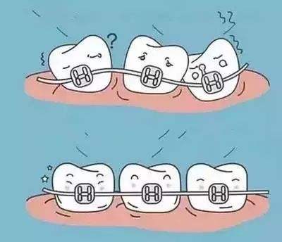 整牙得多长时间？