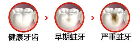 牙疼可能是哪些疾病引起的